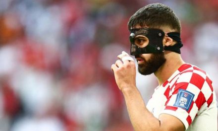 Why are some players using strange face masks in the soccer world cup?